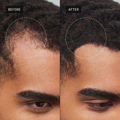 Toppik Hair Building Fibers, Fill In Fine or Thinning Hair Instantly Thicker, Fuller Looking Hair 9 Shades,4 size options
