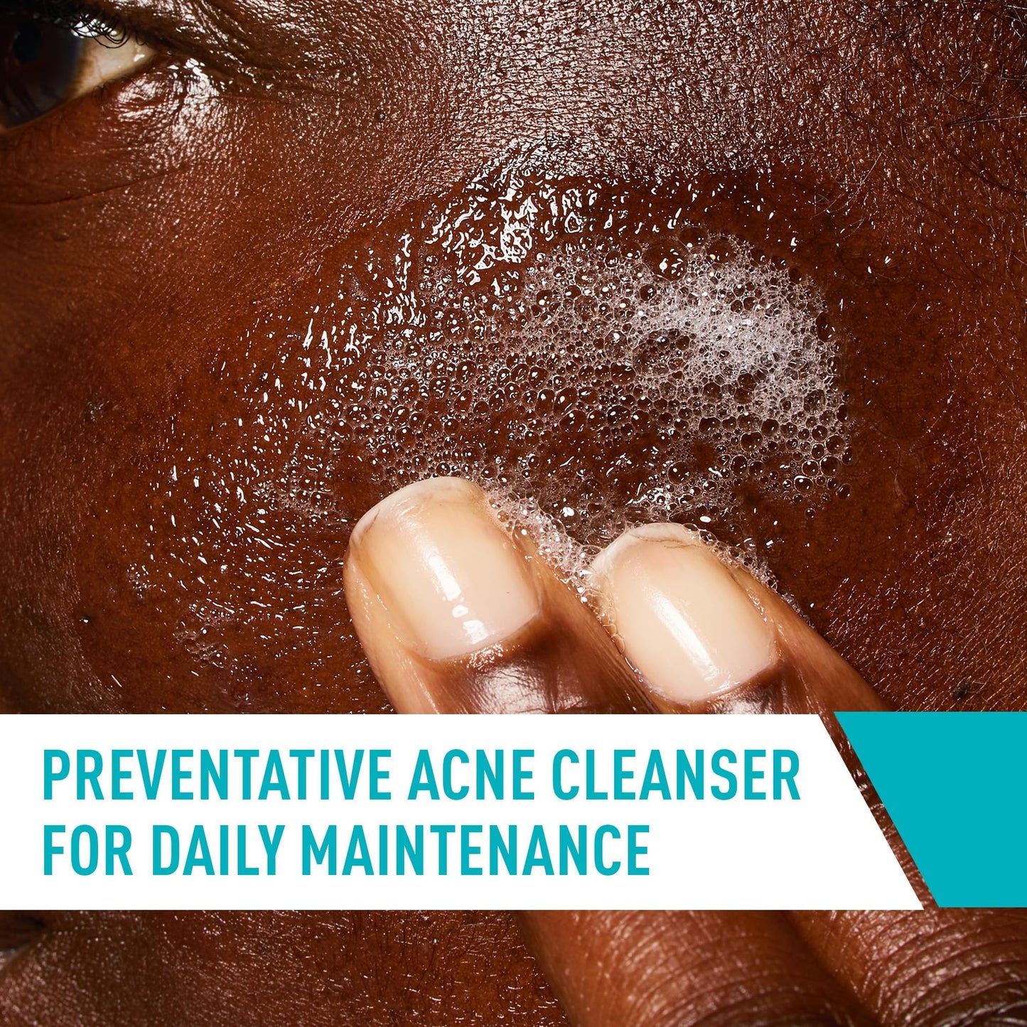 CeraVe Acne Control Cleanser, Face Wash with 2% Salicylic Acid, 16 oz