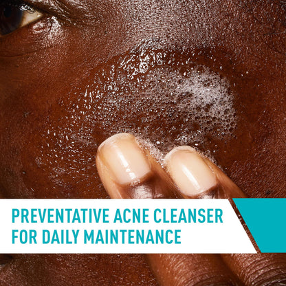 CeraVe Acne Control Cleanser, Face Wash with 2% Salicylic Acid, 16 oz