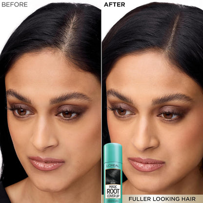 L'Oreal Paris Magic Root Cover Up Gray Hair Spray, 100% Gray Hair Coverage with Buildable, Lightweight, Transfer-Resistant, and Temporary Formula, Ammonia-Free, Dark Blonde, 2 oz (1 Count)