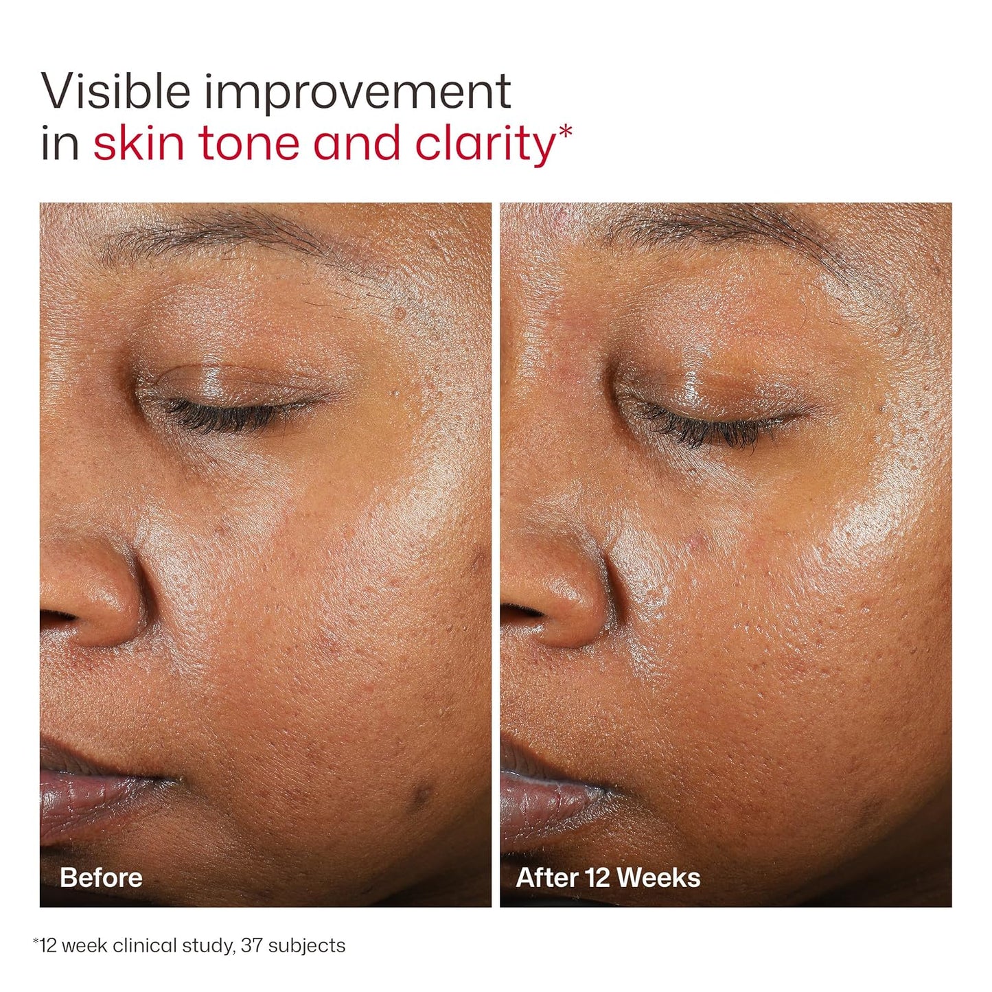 EltaMD UV Clear Face Sunscreen with Zinc Oxide, Oil-Free, SPF 46 and SPF 50